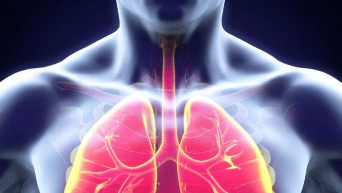 Rak Płuca Jakie Są Jego Objawy Nowotwory Polkipl 8282