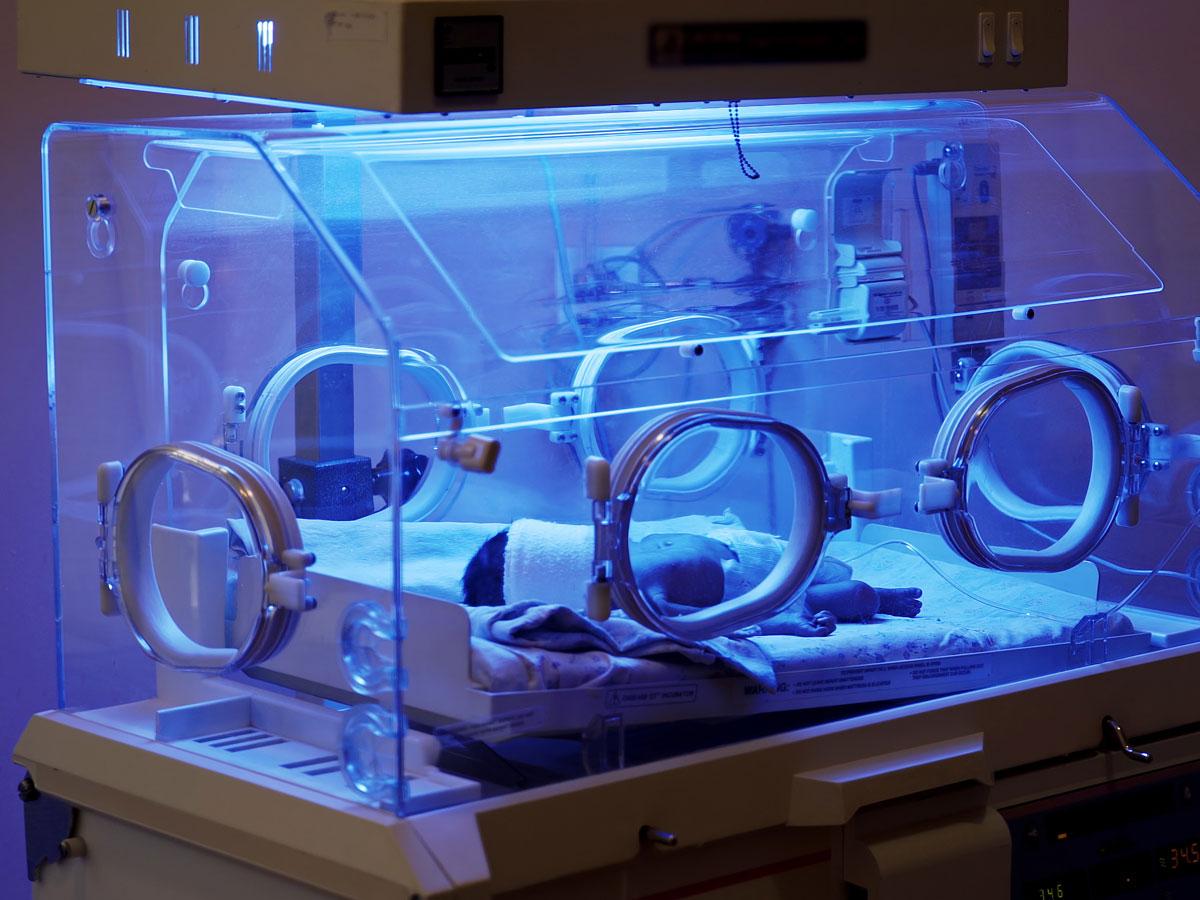 fototerapia w inkubatorze