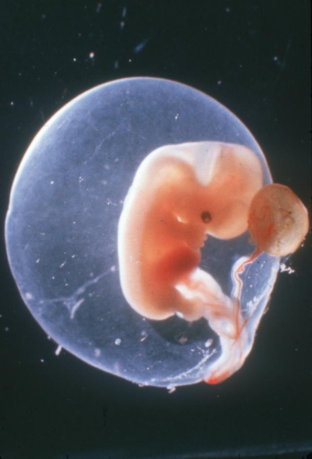 6 неделя что происходит с малышом. Эмбрион на 6 неделе беременности. Эмбрион 5-6 недели беременности. Беременность 6 недель фото эмбриона.