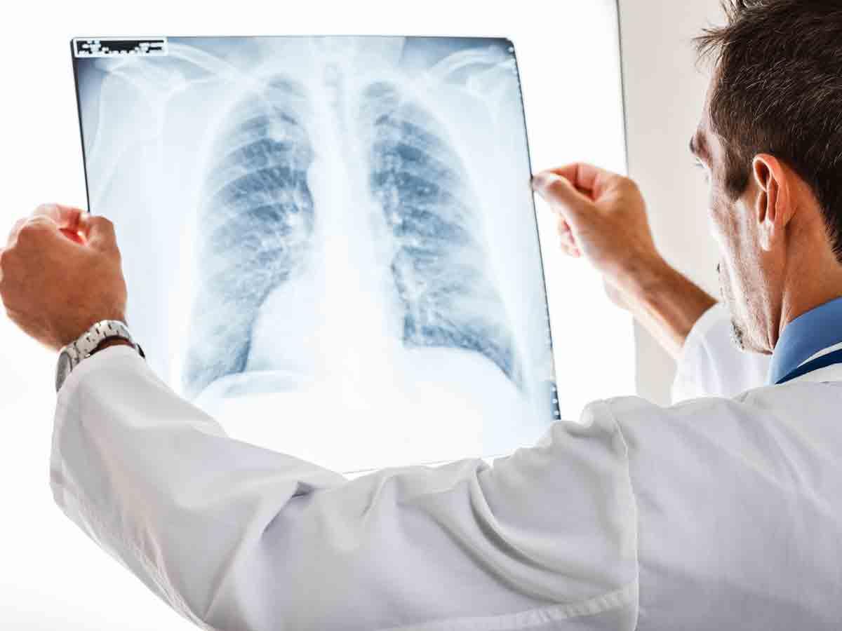 diagnostyka zapalenia płuc