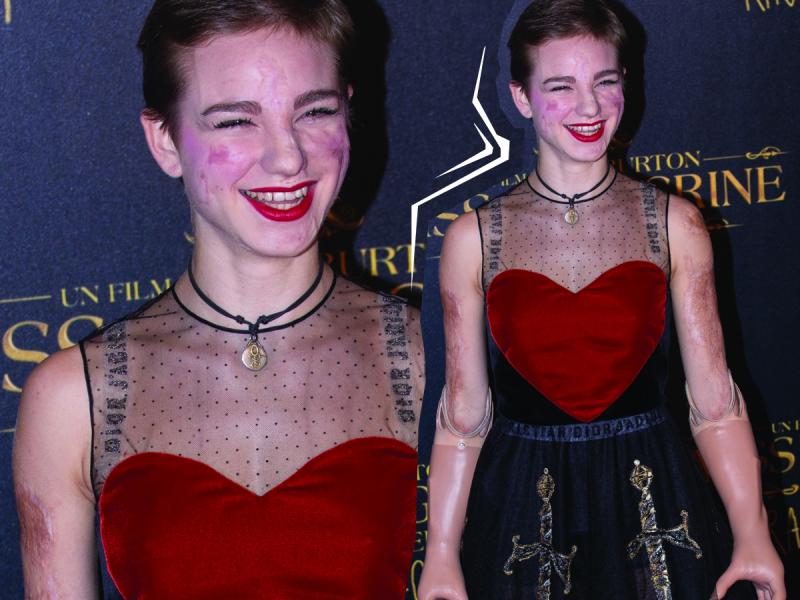 Beatrice Vio paraolimpijka Styl gwiazd Czerwony dywan Trendy