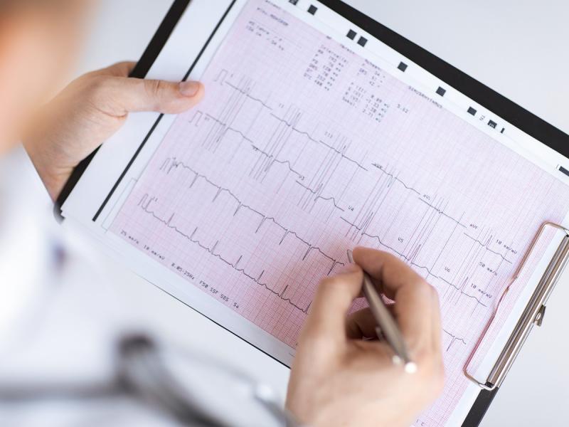 Ekg Wyniki Interpretacja Badania Ekg Serca Diagnostyka Polki Pl