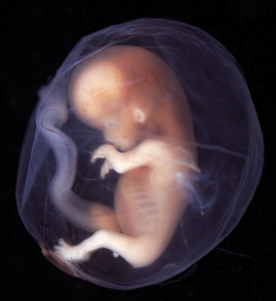 nieinwazyjna diagnostyka prenatalna, płód w 10. tygodniu ciąży