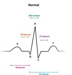 Wyniki badania EKG